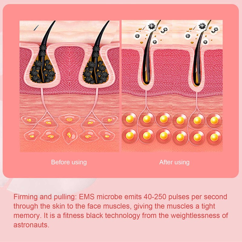 EMS Face Machine Househod Face Serum Imports Skin Rejuvenation Face