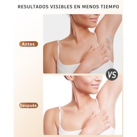 Depiladora Láser IPL para Mujer y Hombre, Depilación en Casa