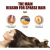 Champú X Hair Growth, Champú Para Engrosar El Cabello, Anti-