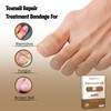 Toe Nail Cover Up Bandages for Unsightly, Broken or Cracked