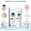 2 Pcs Acanthosis Nigricans Crema, Crema Correctora de Manchas Oscuras