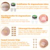 Joycabin Ingrown Toenails Set, Toenail Correction Patch, Ingrown Toenail Correction
