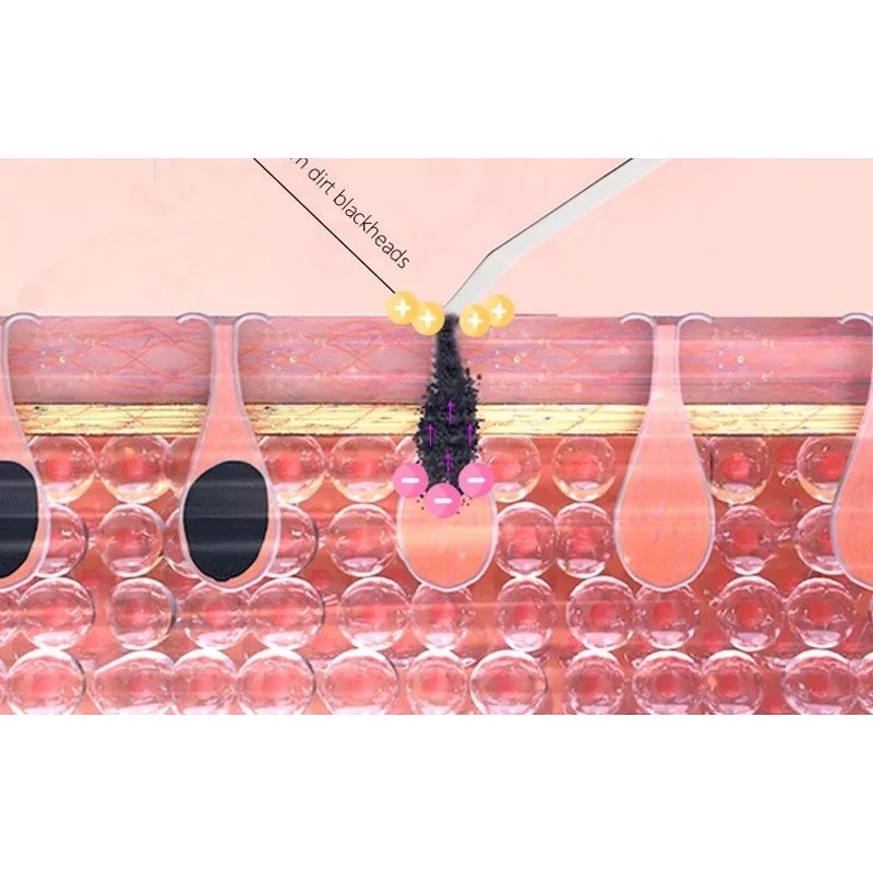 Muye Skin Scrubber Ultrasónico - Galvánica & Pelling + Colageno