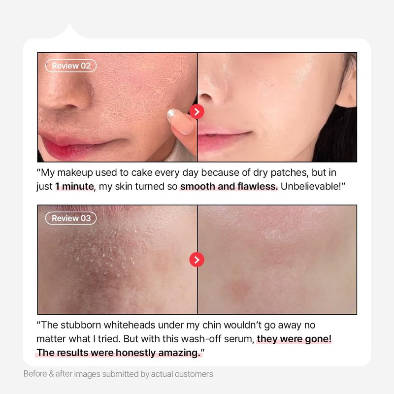 Parnell AHA 9.12% Omija Ceramic Wash-Off Serum | 1-Minute Face