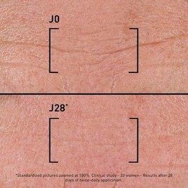 Filorga Suero Time Filler Intensive 5xp Multicorrección Arrugas Complejo Neuropeptídico Ácido Hialurónico