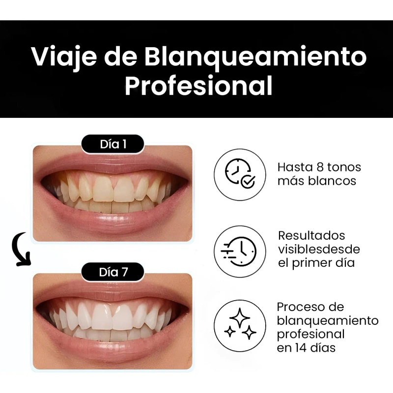 Freshmile Tiras Blanqueadoras Dentales Con Carbón Activado