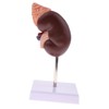 Kidney Model Anatomy Normal Human Anatomical Teaching Doctors Office Educational