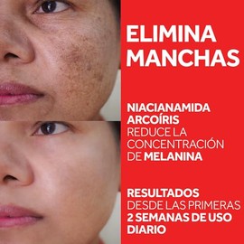 Tenderskin Sérum Concentrado Antimanchas B3 Niacinamida Arcoíris 30ml | Tratamiento Antipigmentación y Melasma, Reduce Manchas Oscuras, Hiperpigmentac