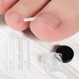 Ingrown Toenail Correction Tip Cerebral Palsy Corrector Strip 10P Tape Band Ingrown Toenail Retractor Self Stick protect 6ea
