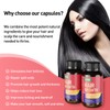 XKQ Hair Growth Supplements, Supports Hair Health & Fullness with