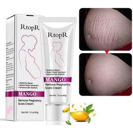 Crema de Estrías y Cicatrices de Mango, Estrías y Crema de Eliminación de Cicatrices para El Embarazo, Estrías Cremas de Vientre Cicatrices para Arrugas, Obesidad Grasa Estrías Hidratante,
