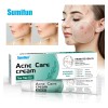 Creme De Tea Tree Oil Para Acne, Espinhas E Pele