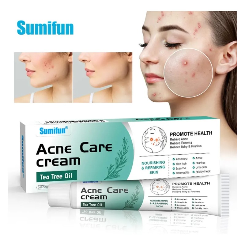 Creme De Tea Tree Oil Para Acne, Espinhas E Pele