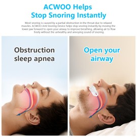 ACWOO Aufbissschienen Schnarch Stopper, Anti-Schnarchschiene, Anti Schnarch Gegen Schnarchen, Effektiv Schnarchstopper Mundstück Beißschiene Nacht Gegen für männer frauen Sicher und Langlebig