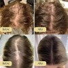 2pcs Aceite Esencial Para Cuidado Del Cabello Veganic Hair