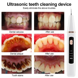 Hailicare Electric Ultrasonic Tooth Stains Dental Scaler Tartar Calculus Plaque Remover