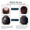 Pack de 3 Esencias Anticaída MOPOYAT para Hombre con Extra