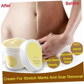 2 Piezas crema para cicatrices eliminación de cicatrices eliminación de estrías crema de estrías tratamiento de estrias