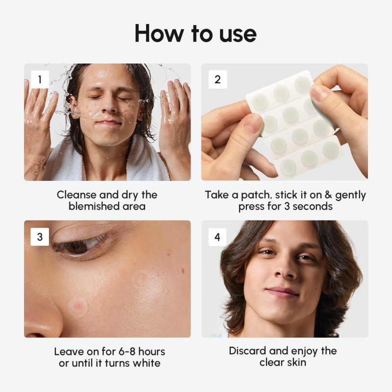 MAREE Pimple Patches for Face -Acne Clearing Device-Clear Acne Patches