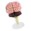 1pc Disassembled Anatomical Human Brain Model Medical Teaching Tool Toy