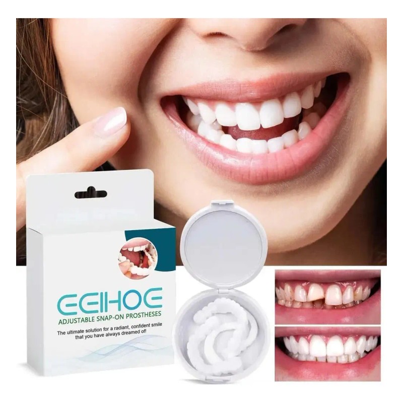 Dientes Postizos Temporal Sonrisa Dental Carilla