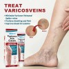 Crema Varicoso Contra Varices De 3 Piezas Para Fortalecer La