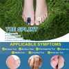 YJWZWE Toe Splint for Broken Toe U-Shaped Toe Corrector Brace