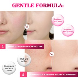 Arbutin 7% + Tranexamic Acid 4% Face Cream – Dark Spot Corrector for Pigmentation, Blemishes, Uneven Skin Tone & Post-Acne Marks – Korean Skincare, 50ml (1)