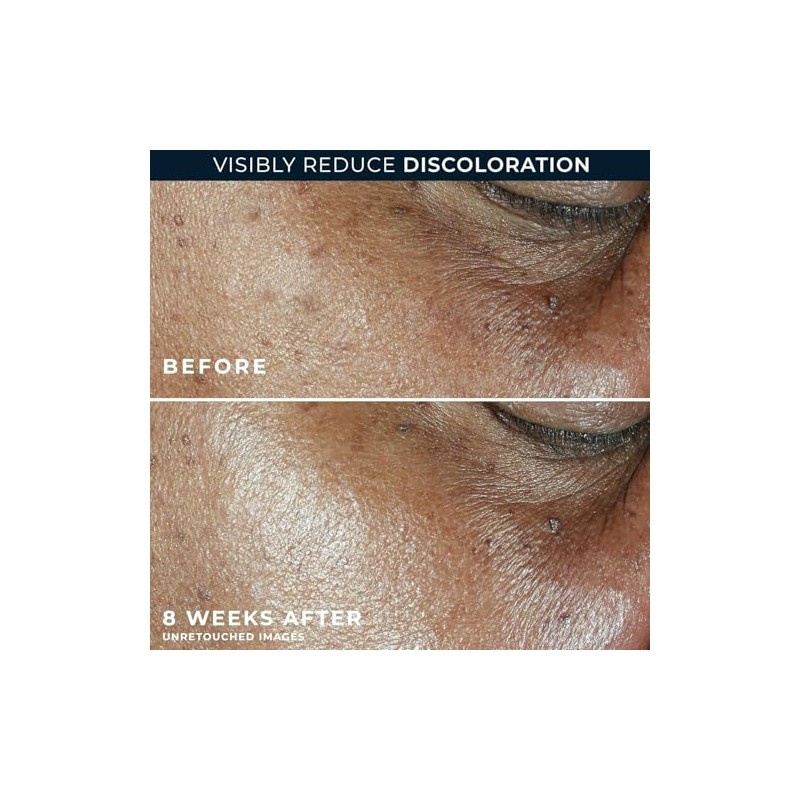 Hidratante Diario RoC Multi Correxion 5-en-1 1.7 oz