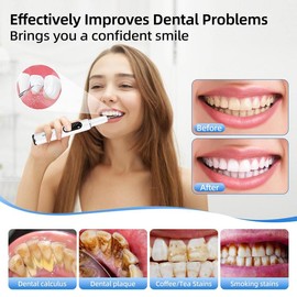 Rechargeable Electric Teeth Cleaner, 5 Modes Teeth Polisher with 2 Replacement Heads, Oral Care Tool for Women & Men