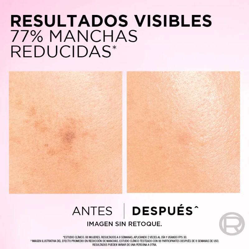 Crema Día Anti-manchas Con Ácido Glicólico L'oréal Paris Tod Todo