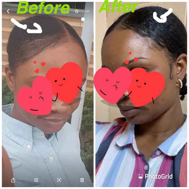 100% Pure Chebe Hair Loss Butter/Massive growth/Moistur