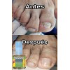 Esmalte Cura Y Quita Hongos Tratamiento Uñas Manos Y Pies
