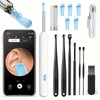 6-in-1 Wireless Earwax Removal Kit with Camera and Light, 6pcs