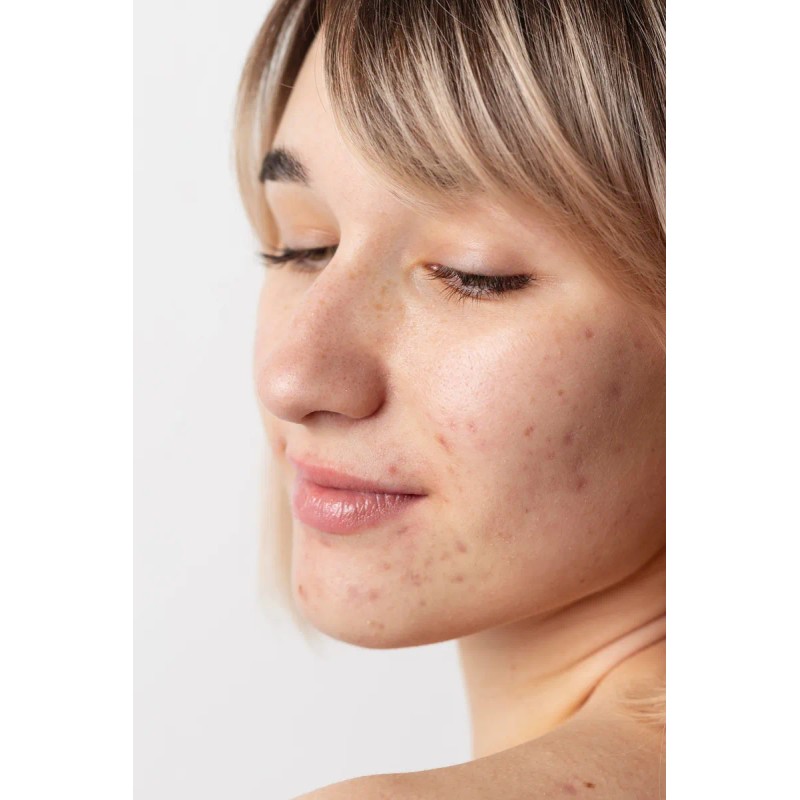 Ducray Melascreen Crema Despigmentante 30ml Día/noche Todo Tipo De Piel