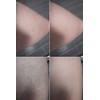 Keratosis Pilaris Body Wash – Targets Bumpy Skin, Strawberry Legs