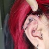 Bloomfall Clear Piercing Disc For Piercing Bump,Nose Piercing Bump Treatment