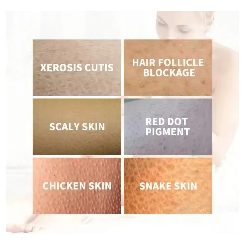 Pomada Herbal Antibacterial para Cuidado de la Piel Sensible Irritación,