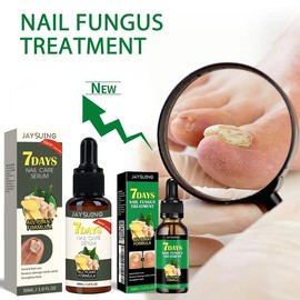 Fix Gray Nails Fast! Jaysuing Ginger Nail Repair Solution – Soft & Shiny! - Specification: 2pcs, Scent: Quantity