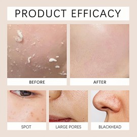 2Pcs Purifying Exfoliating Gel,Purifying Cream,Gentle Face Scrub for Women,Facial Scrub for Soft Dead Skin,Face and Body Facial Exfoliating Cream Scr-ub,Exfo-liating Cleanser,Liquid Exfoliator