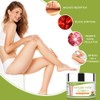 Varicose Vein Cream for Legs - Improves Blood Circulation, Reduces