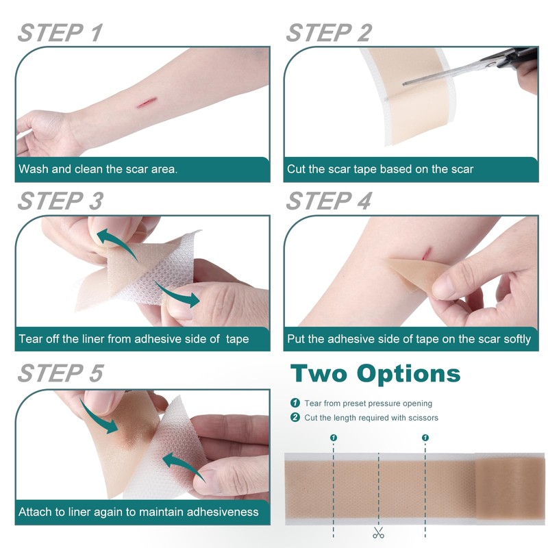 Silicone Scar Sheets (1.6"x 79" Roll-2M), Silicone Scar Tape for