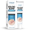 Keloid Bump Removal, Keloid Scar Treatment for Face, Body, Advanced