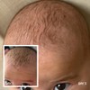 MooGoo Baby & Child Cradle Cap Scalp Cream, 120g