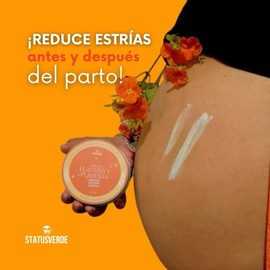 STATUS VERDE, Crema corporal hidratante de ELASTINA y PLACENTA vegetal, ideal para el EMBARAZO, disminuye estrías y celulitis, promueve regeneración celular y produce colágeno, en lata de 200 g