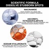 Dark Spot Remover for Face，-Age Spot Remover -Hyperpigmentation Treatment-Sun Spots