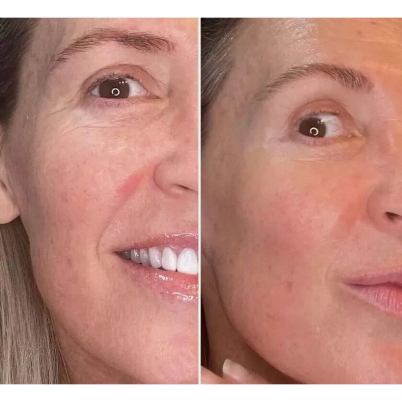 Epoch Cica Balm New Sealed