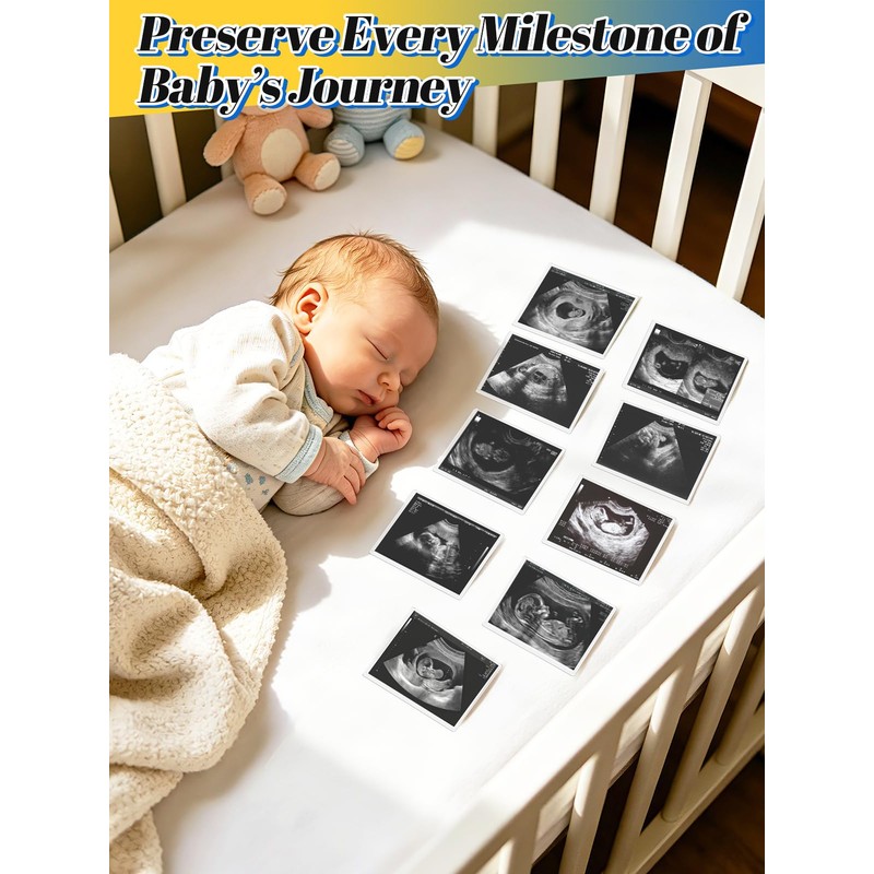 Easy-Slide Photocard Sleeves Photo Protector for 3x4in Ultrasound Pictures