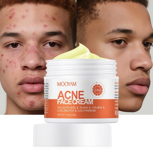 Acne Cream Multi-Acid Deep Relief – 4% Lactic Acid BHA/AHA