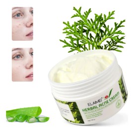 Crema Herbal Antiacné Control Grasa, Granos Espinillas 2 Pzs Acneica Día/noche